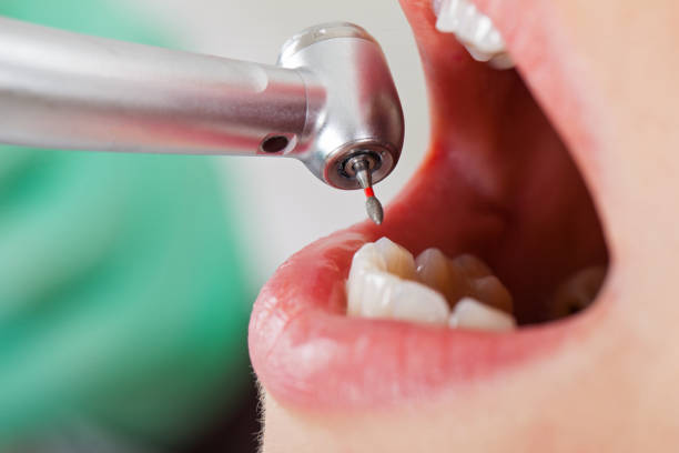 Best Weekend Emergency Dental Services in Stoneville, NC